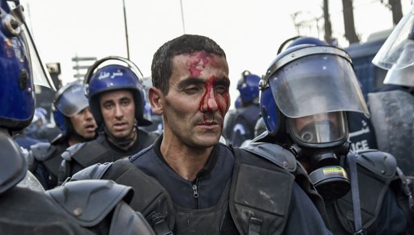 A member of the Algerian security forces is seen with a bloodied face as riot forces respond to protests in the capital Algiers on March 1, 2019, against ailing President Abdelaziz Bouteflika's bid for a fifth term in power. - Sputnik International