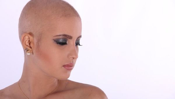 Bald head woman Bald head woman - Sputnik International