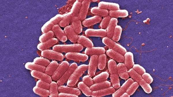 Bacteria with special resistance to antibiotics are increasingly found in the US, increasing worries that the country will soon see a superbug that cannot be treated with known medications - Sputnik International