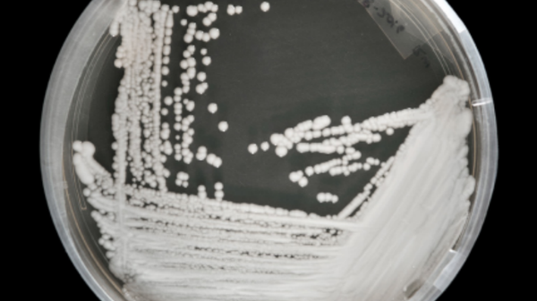 Candida Auris on a petri dish at the CDC - Sputnik International