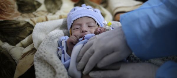 a doctor checks a two-month-old infant suffering from a cholera infection, at Al-Sabeen hospital, in Sanaa, Yemen, on March 30, 2019 a doctor checks a two-month-old infant suffering from a cholera infection, at Al-Sabeen hospital, in Sanaa, Yemen, on March 30, 2019 - Sputnik International