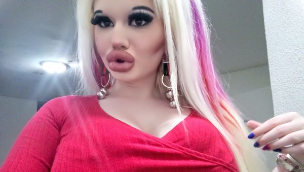 A Bulgarian Girl Has 15 Procedures to Look Like Barbie - Sputnik International
