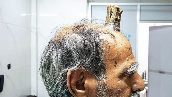 Shyam Lal Yadav Horn  - Sputnik International