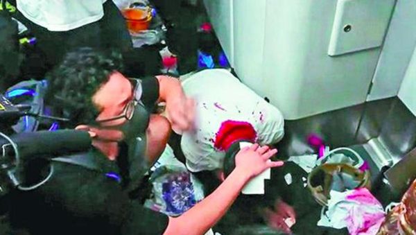 Lee, a student under the age of 18, and his father are suing in response to an attack by the Hong Kong Police Force's Special Tactical Unit raptors, which resulted in 14 stitches to his head, blood clots in various areas and nine days in the hospital - Sputnik International