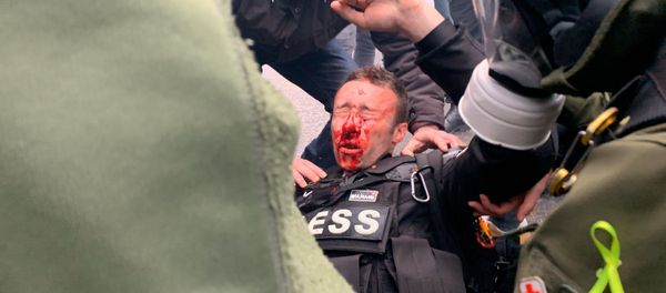 Journalist Seriously Injured During Yellow Vests Protests  - Sputnik International