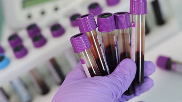  Blood samples - Sputnik International