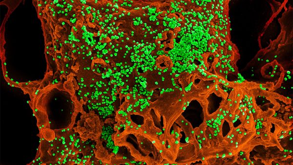 MERS Coronavirus Particles - Sputnik International