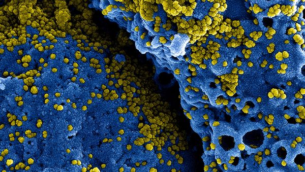 MERS Coronavirus Particles - Sputnik International