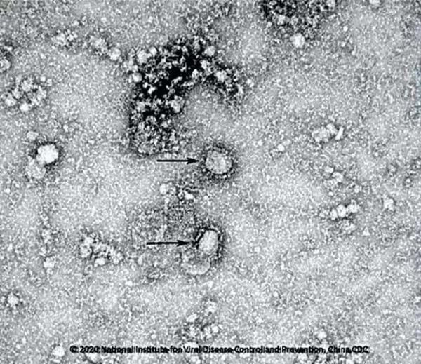 Secure, Contain, Protect: How China and Other Countries Fight Against New Coronavirus - Sputnik International