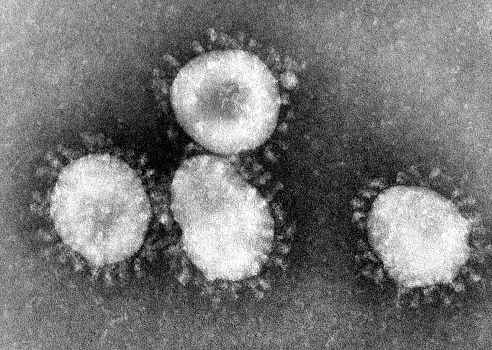 Israel to the Rescue? New Drug Developed in Tel Aviv Hospital May Help Battle Severe COVID-19 Cases - Sputnik International, 1920, 22.02.2021