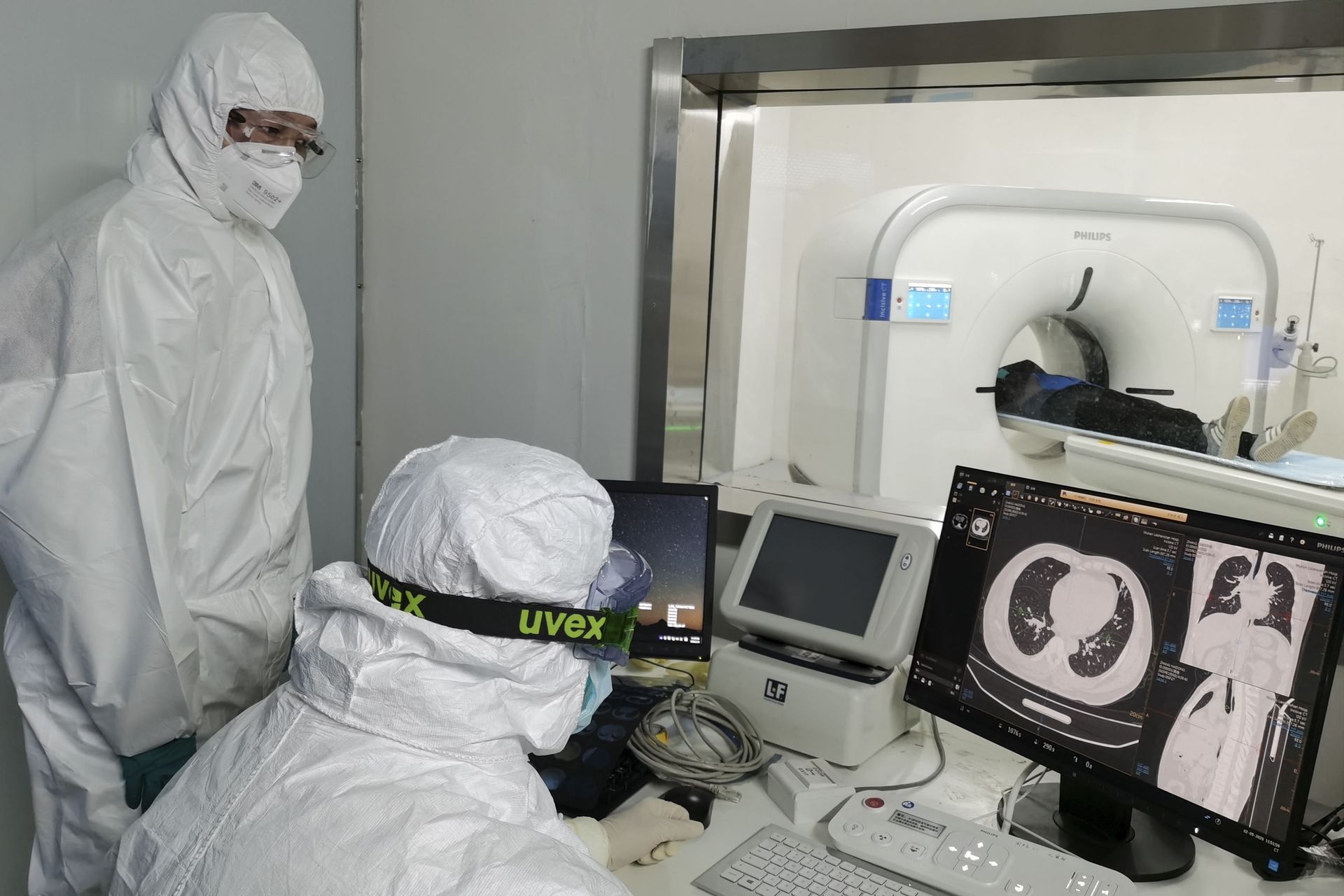 In this Sunday, Feb. 9, 2020, photo released by Xinhua News Agency, doctors scan a patient's lungs at Huoshenshan temporary hospital built for patients diagnosed with coronavirus in Wuhan in central China's Hubei province. Mainland China has reported another rise in cases of the new virus after a sharp decline the previous day, while the number of deaths grow over 900, with at least two more outside the country. (Gao Xiang/Xinhua via AP) - Sputnik International, 1920, 07.09.2021