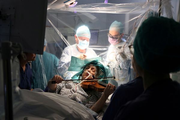 Patient Dagmar Turner, 53, plays violin while surgeons remove her brain tumour at King's College Hospital in London, Britain, January 31, 2020 in this handout image obtained by Reuters on February 19, 2020.  - Sputnik International