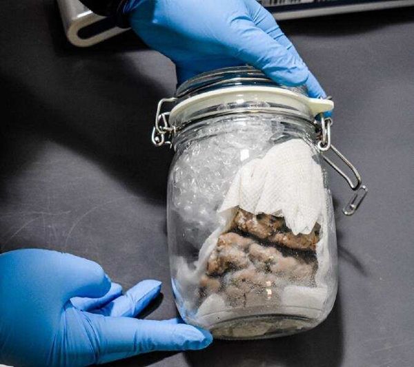 Photo: US Border Patrol Discovers Human Brain Tucked Into Package From Canada - Sputnik International