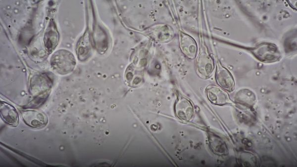 Marine biologists have discovered a living creature that does not need oxygen to survive, according to a new study published in the journal Proceedings of the National Academy of Sciences - Sputnik International