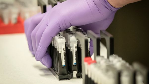Samples are tested for respiratory viruses during a visit by Britain's Chancellor of the Exchequer Rishi Sunak - Sputnik International