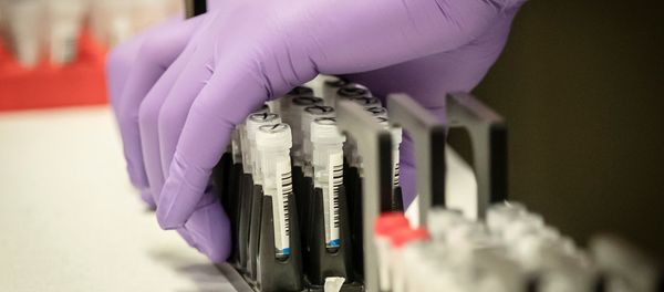 Samples are tested for respiratory viruses during a visit by Britain's Chancellor of the Exchequer Rishi Sunak Samples are tested for respiratory viruses during a visit by Britain's Chancellor of the Exchequer Rishi Sunak - Sputnik International