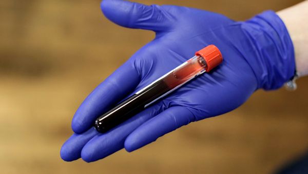 A phlebotomist holds freshly donated blood, following reports from Seattle and King County Public Health that the local blood supply is in danger of collapse due to canceled blood drives and lost donations out of fears of coronavirus disease (COVID-19) cases in the country, during a Bloodworks Northwest blood drive at the Shoreline Masonic Lodge in Shoreline, Washington, U.S. March 15, 2020. A phlebotomist holds freshly donated blood, following reports from Seattle and King County Public Health that the local blood supply is in danger of collapse due to canceled blood drives and lost donations out of fears of coronavirus disease (COVID-19) cases in the country, during a Bloodworks Northwest blood drive at the Shoreline Masonic Lodge in Shoreline, Washington, U.S. March 15, 2020. - Sputnik International