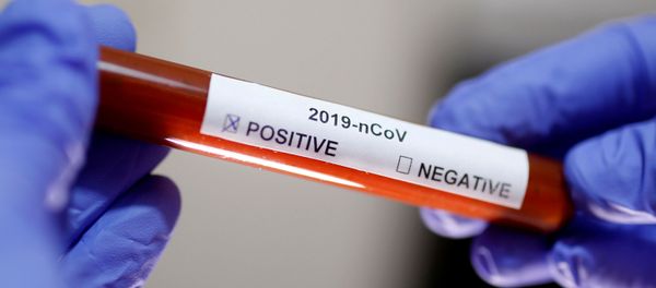 Test tube with Corona virus name label is seen in this illustration taken on January 29, 2020 Test tube with Corona virus name label is seen in this illustration taken on January 29, 2020 - Sputnik International