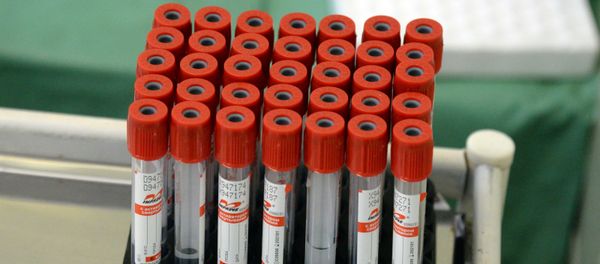 Russia Coronavirus Tests - Sputnik International