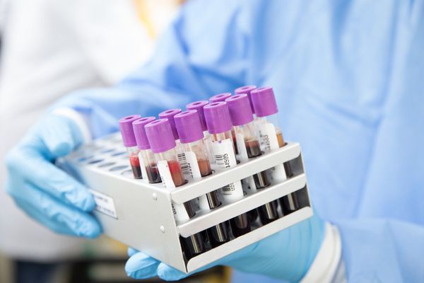 The Truth Behind COVID-19 Vaccine Expectations - Sputnik International