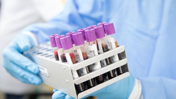 Vaccine testing Vaccine testing - Sputnik International