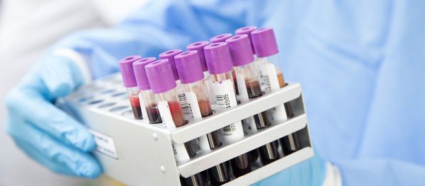 Vaccine testing Vaccine testing - Sputnik International