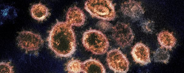 Novel Coronavirus SARS-CoV-2 - Sputnik International