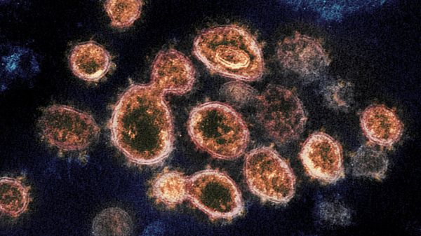 Novel Coronavirus SARS-CoV-2 - Sputnik International