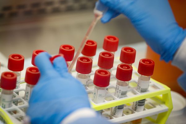 Amazon to Deliver COVID-19 Swab Kits to UK Homes Amid Government Testing Target Shortfalls - Report Amazon to Deliver COVID-19 Swab Kits to UK Homes Amid Government Testing Target Shortfalls - Report - Sputnik International