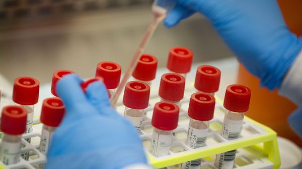 A laboratory technician prepares COVID-19 patient samples for semi-automatic testing at Northwell Health Labs, Wednesday, March 11, 2020, in Lake Success, N.Y. The US Food and Drug Administration has approved faster testing protocols as the viral outbreak continues to spread worldwide. For most people, the new coronavirus causes only mild or moderate symptoms. For some it can cause more severe illness - Sputnik International