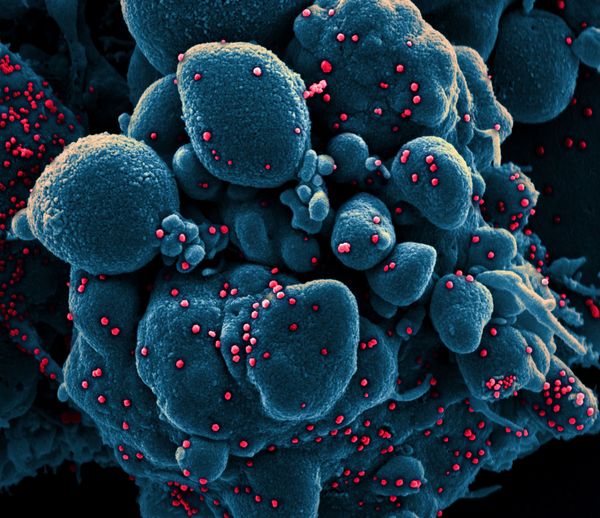 COVID-19 Through the Prism of a Microscope - Sputnik International