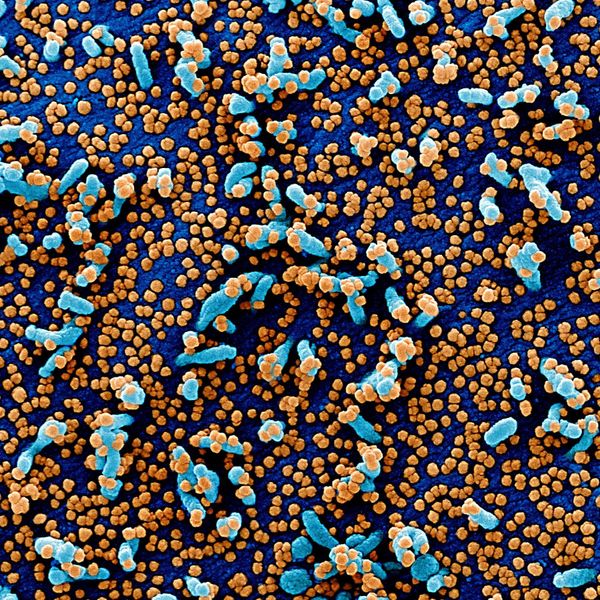 COVID-19 Through the Prism of a Microscope - Sputnik International