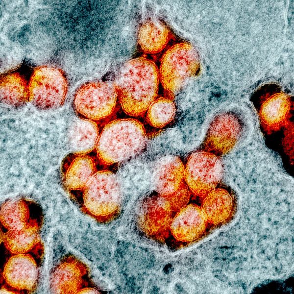 COVID-19 Through the Prism of a Microscope - Sputnik International