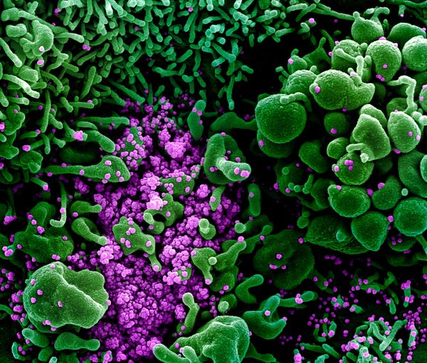 COVID-19 Through the Prism of a Microscope - Sputnik International