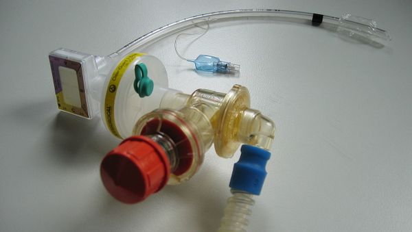 Ventilator - Sputnik International