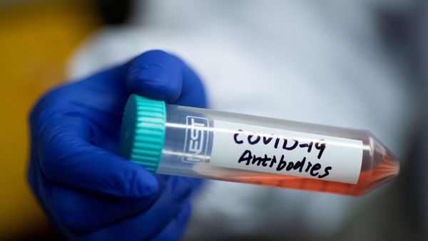 cientist Linqi Zhang shows a tube with a solution containing COVID-19 antibodies in his lab where he works on research into novel coronavirus disease (COVID-19) antibodies for possible use in a drug at Tsinghua University's Research Center for Public Health in Beijing, China, March 30, 2020 - Sputnik International