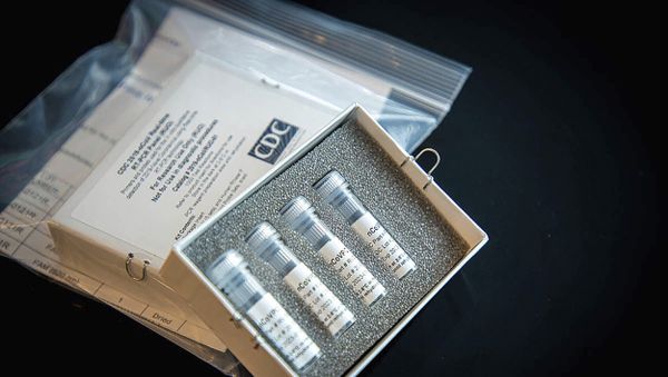 Laboratory test kit for the new coronavirus Laboratory test kit for the new coronavirus - Sputnik International