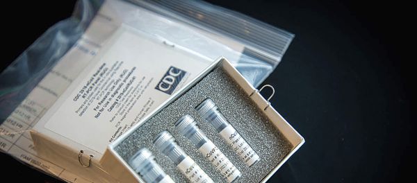 Laboratory test kit for the new coronavirus Laboratory test kit for the new coronavirus - Sputnik International