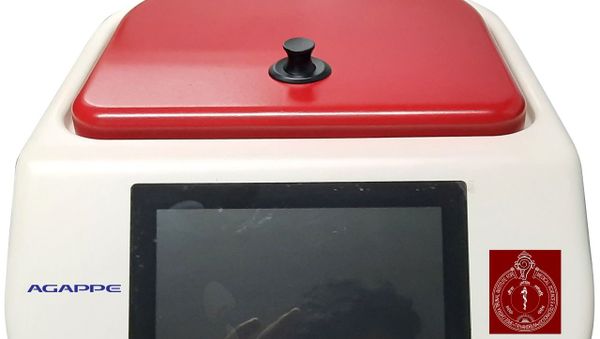 A cheap test kit for COVID-19 developed by a Kerala-based lab at the Sree Chitra Tirunal Institute of Medical Sciences and Technology  - Sputnik International