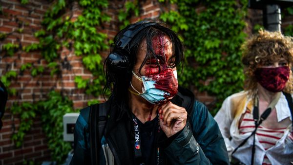 A journalist is seen bleeding after police started firing tear gas and rubber bullets near the 5th police precinct following a demonstration to call for justice for George Floyd, a black man who died while in custody of the Minneapolis police, on May 30, 2020 in Minneapolis, Minnesota A journalist is seen bleeding after police started firing tear gas and rubber bullets near the 5th police precinct following a demonstration to call for justice for George Floyd, a black man who died while in custody of the Minneapolis police, on May 30, 2020 in Minneapolis, Minnesota - Sputnik International