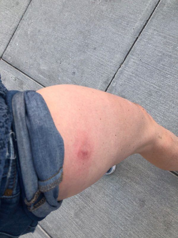 Sputnik Journalist Wounded by US Police While Covering Protests in Washington, DC Sputnik Journalist Wounded by US Police While Covering Protests in Washington, DC - Sputnik International