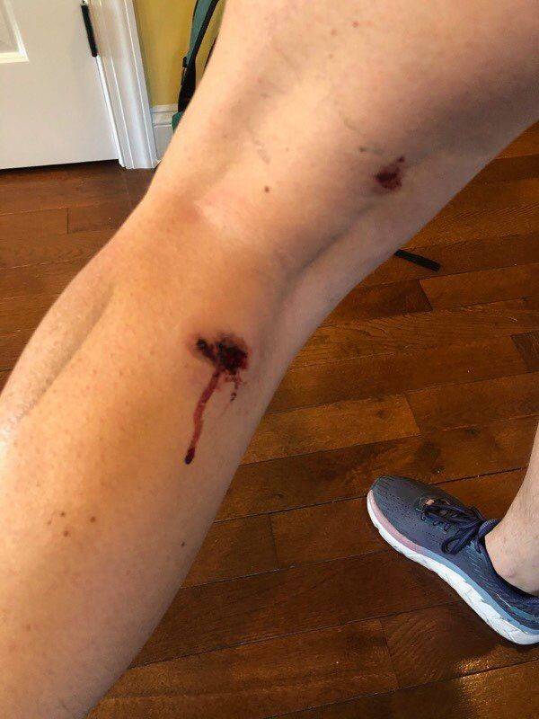 Sputnik Journalist Wounded by US Police While Covering Protests in Washington, DC Sputnik Journalist Wounded by US Police While Covering Protests in Washington, DC - Sputnik International