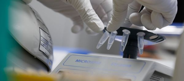 A scientist conducts sample​ sedimentation during the research and development of a vaccine against the coronavirus disease (COVID-19) at a laboratory of BIOCAD biotechnology company in Saint Petersburg, Russia June 11, 2020. - Sputnik International