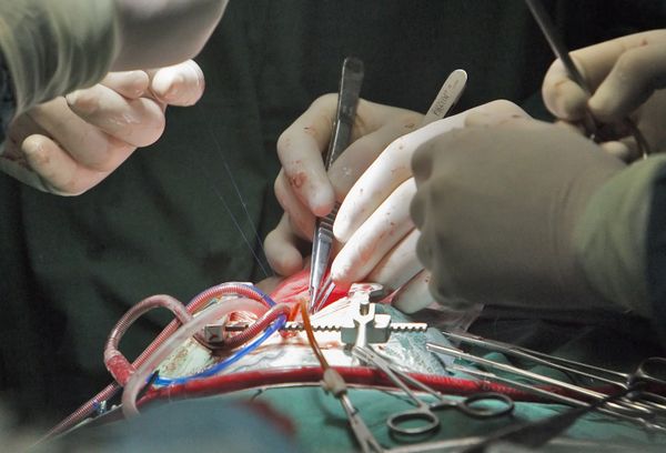 Belgian surgeons implant heart muscle made from bone marrow  - Sputnik International