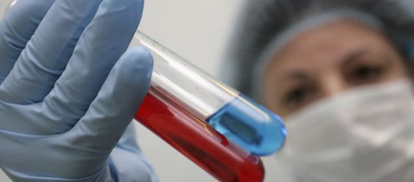 New HIV prevention medicine is in the advanced stages of clinial research New HIV prevention medicine is in the advanced stages of clinial research - Sputnik International