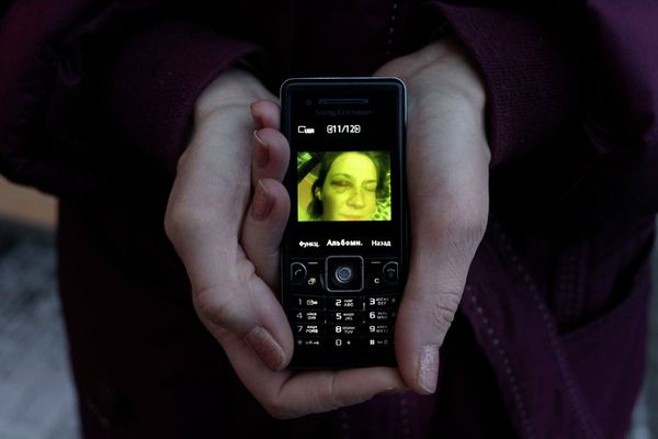 Yekaterina Vingorovna, 39, holds a telephone showing a picture of herself bruised and battered. Every hour, one Russian woman dies at the hands of her husband or partner. - Sputnik International
