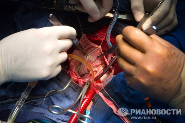 Moscow surgeons perform rare heart operation  - Sputnik International
