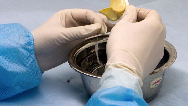 English surgeons could face penalties if they refuse to disclose their mortality rates. - Sputnik International