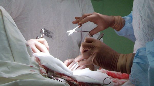 Russian Surgeon Stole Heroin From Drug Mule’s Stomach – Police - Sputnik International