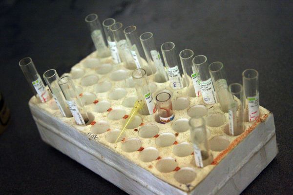 780,000 people in Russia are currently registered as HIV-positive - Sputnik International